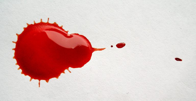 Come Si Tolgono Le Macchie Di Sangue